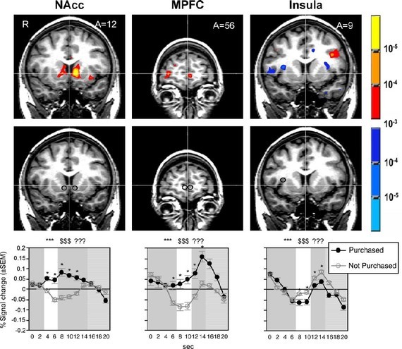 The Neurological Pleasures of Fast Fashion